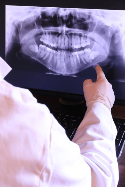 Best Emergency Tooth Extraction in Preston, ID